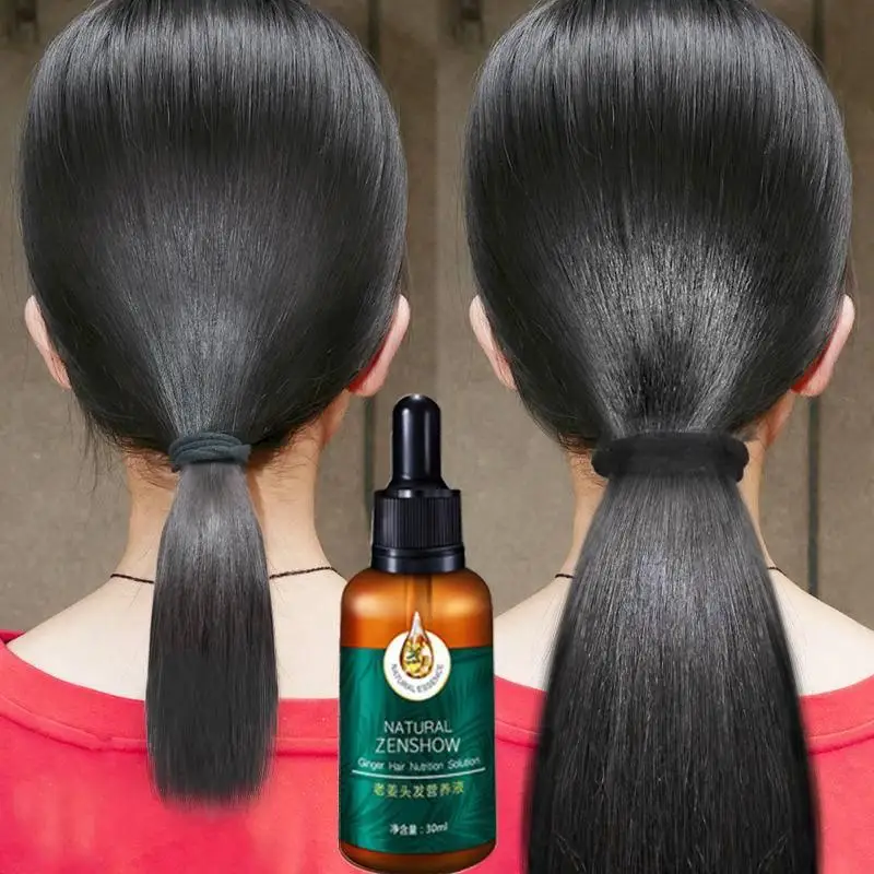 Hair Care Herbal Products - Gember Haargroei Etherische Olie Kruidenhaarverzorging Anti-Haaruitval
