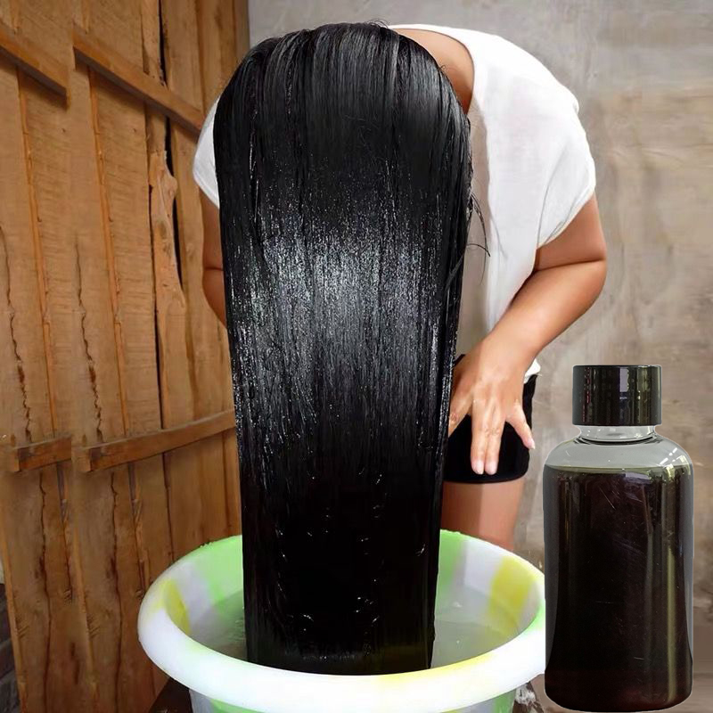 Hair Care Herbal Products - Chinese Kruiden Haarverzorging Haargroei Producten 50Ml