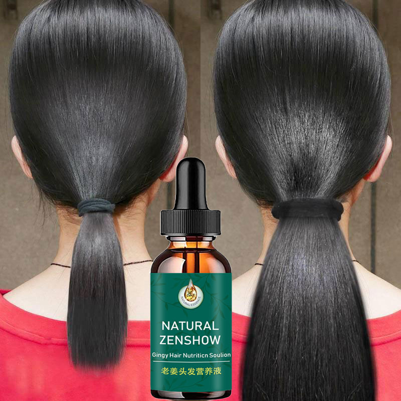 Hair Care Herbal Products - Gember Haargroei Etherische Olie Kruidenhaarverzorging Anti-Haaruitval