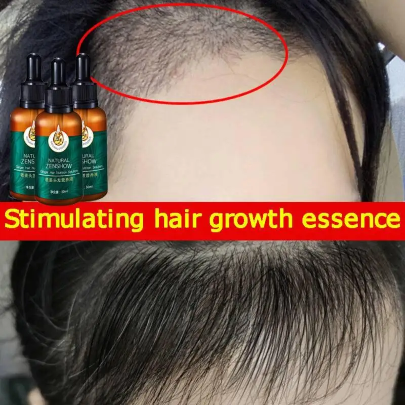 Gember Haargroei Etherische Ol - Hair Care Herbal Products recensie en prijs