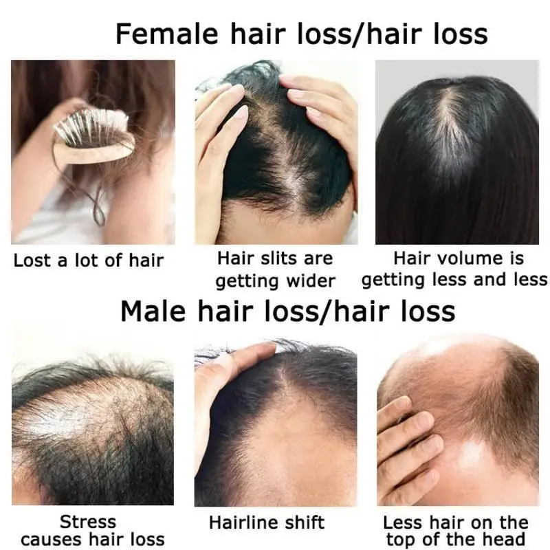 Gember Haargroei Etherische Ol - Hair Care Herbal Products recensie en prijs