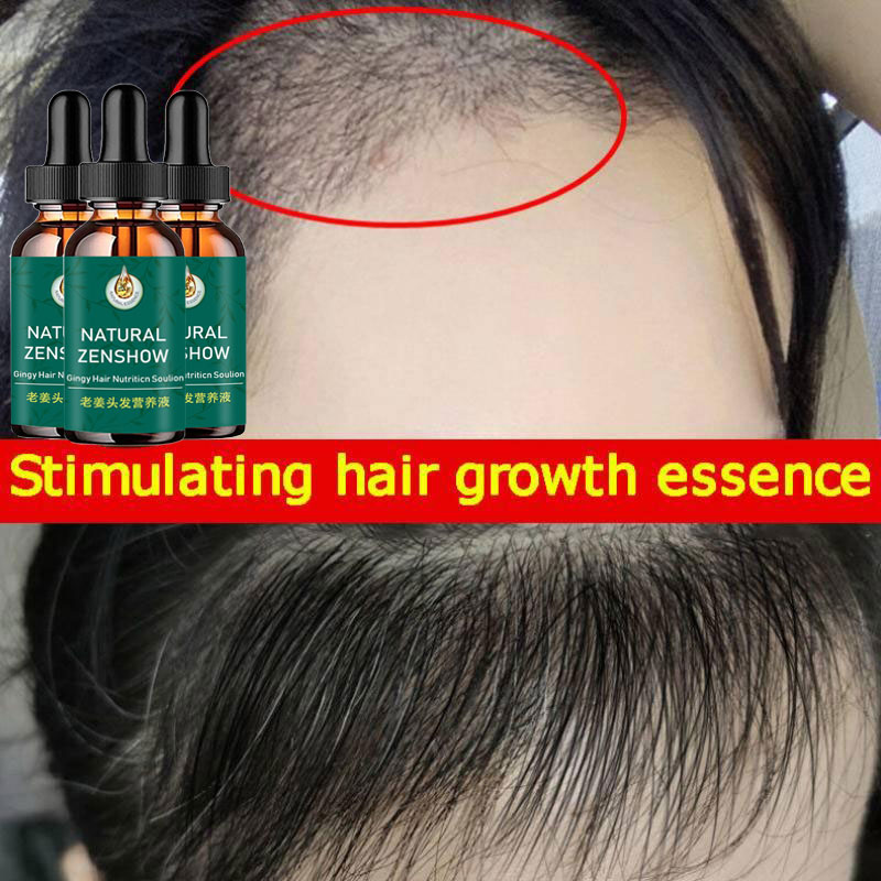 Gember Haargroei Etherische Ol - Hair Care Herbal Products recensie en prijs