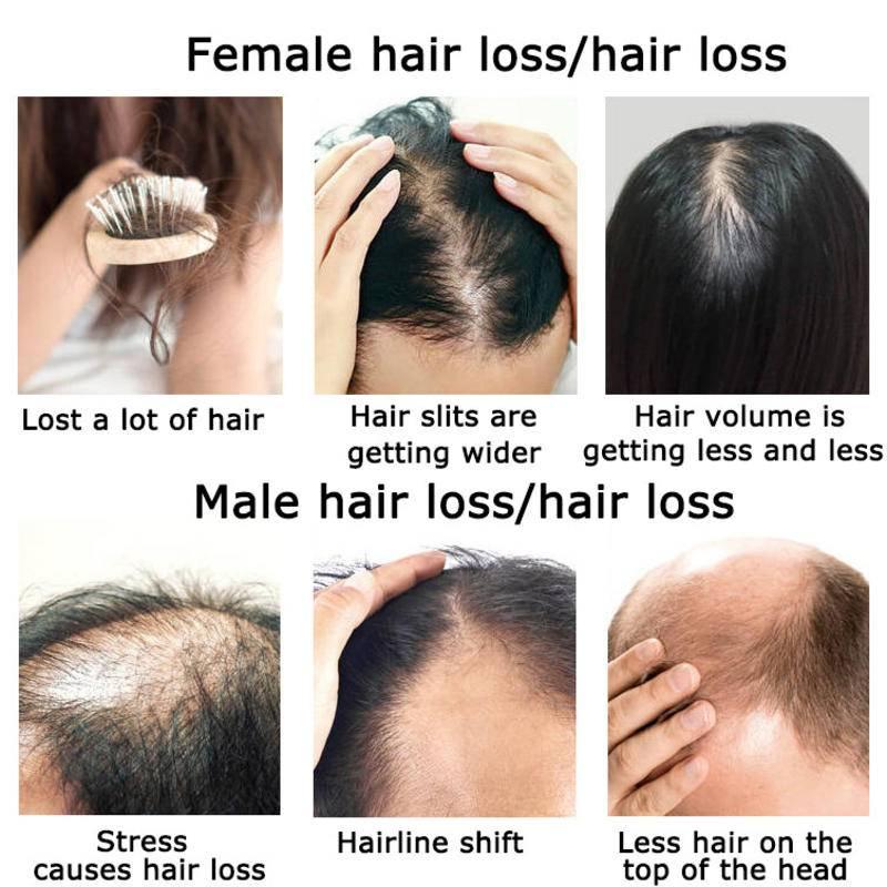 Gember Haargroei Etherische Ol - Hair Care Herbal Products recensie en prijs