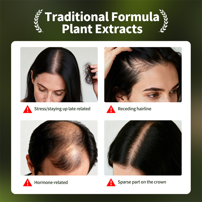 Natuurlijke Haargroei Set Usma - Hair Care Herbal Products recensie en prijs