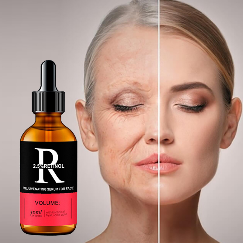 Gezicht Serum Huidverzorging V - The Ordinary Serum Hyaluronic Acid recensie en prijs