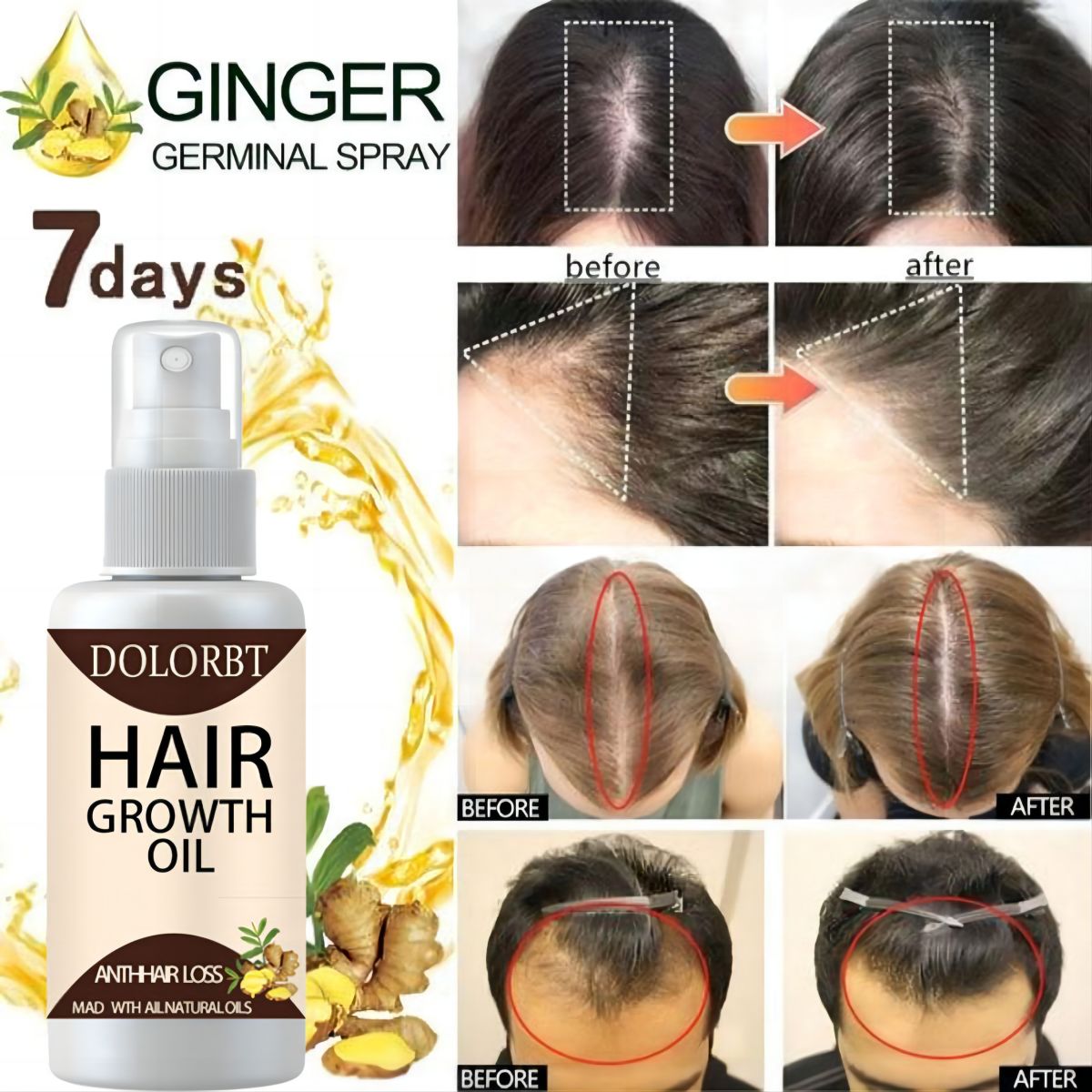 Haargroei Essentie Olie Spray  - Hair Care Herbal Products recensie en prijs