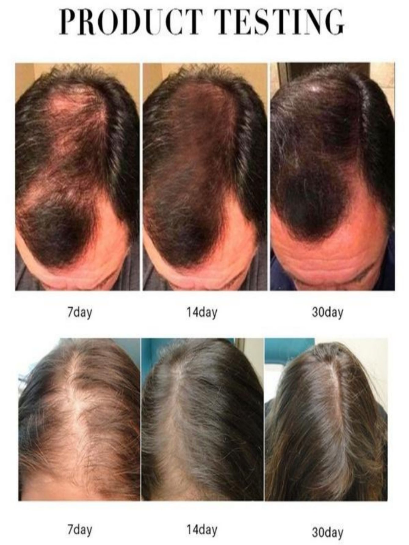 Haargroei Essentie Olie Spray  - Hair Care Herbal Products recensie en prijs