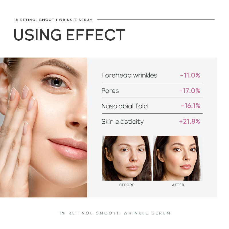 Quiyum 1% Retinol Smooth Wrink - The Ordinary Serum Hyaluronic Acid recensie en prijs
