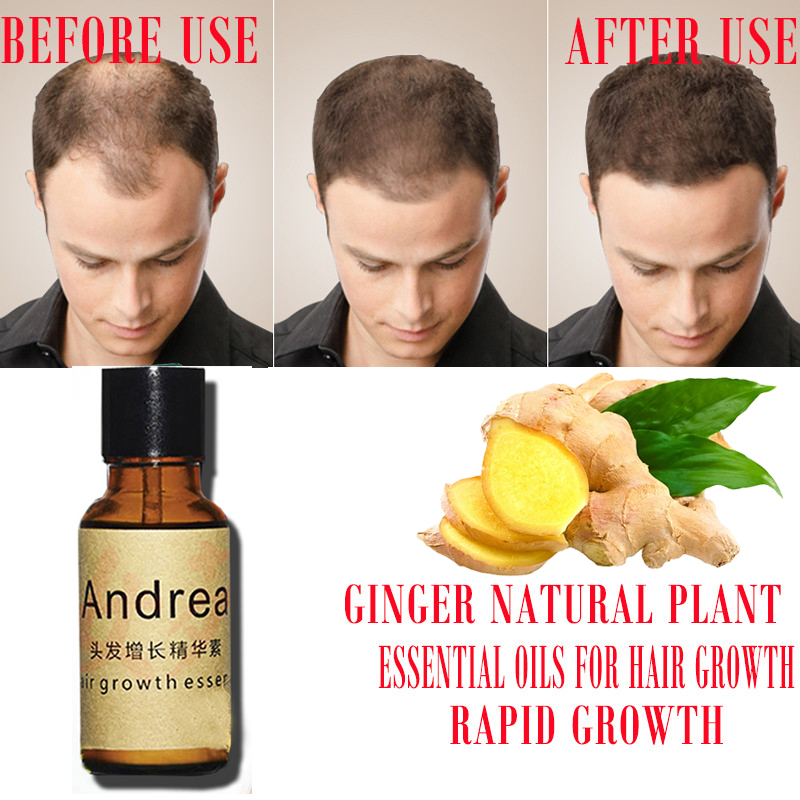 2/5/10 Stuks Andrea Haargroei  - Hair Care Herbal Products recensie en prijs