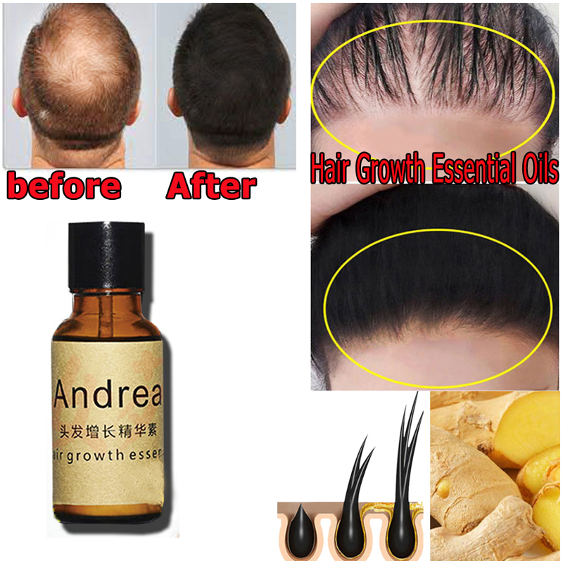 2/5/10 Stuks Andrea Haargroei  - Hair Care Herbal Products recensie en prijs
