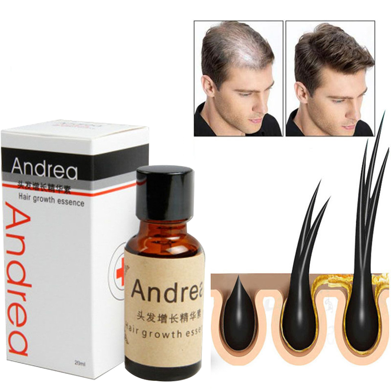 2/5/10 Stuks Andrea Haargroei  - Hair Care Herbal Products recensie en prijs