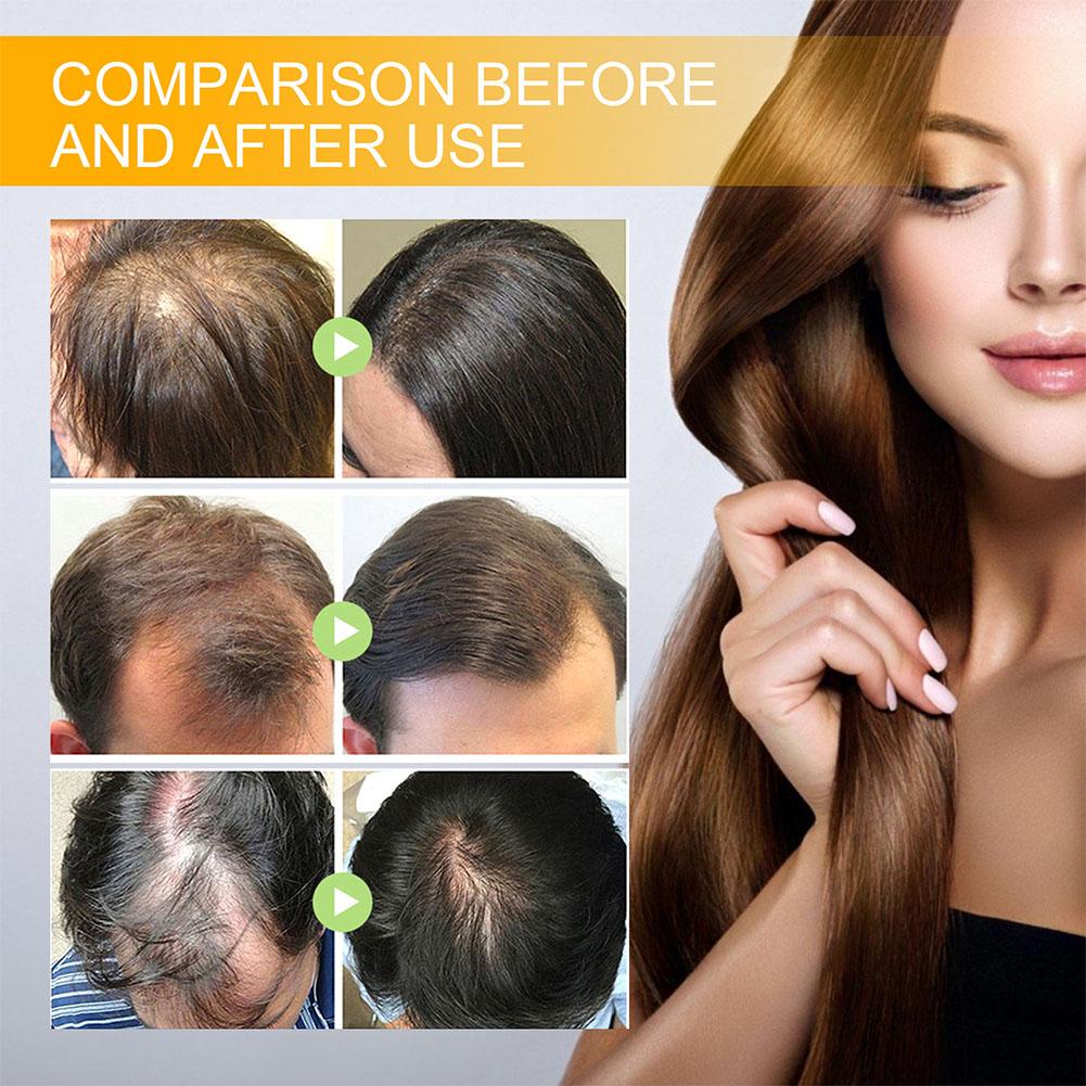 5/3/1pcs Biotine Snelle Haargr - Hair Care Vitamin recensie en prijs